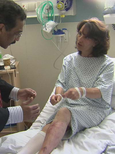 Shattered Leg Rebuilt Using Stem Cells